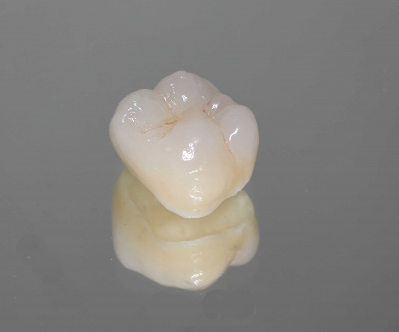 <span lang ="en">ZIRCONIA CROWNS IN TURKEY</span>