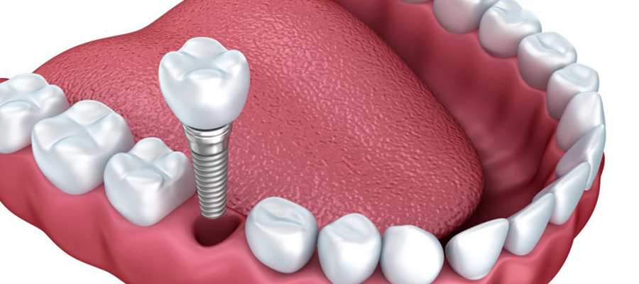 Dentiste en Turquie